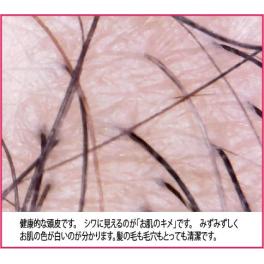 浜松の美容室カミキリベヤでは頭皮をマイクロスコープで確認できます